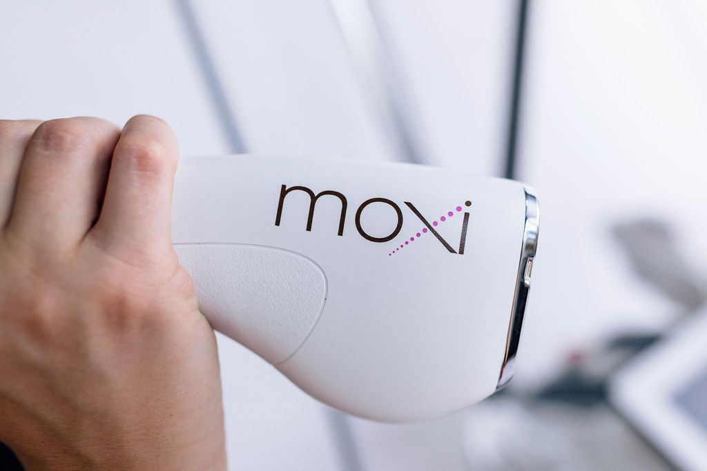 Hand holding Moxi laser device for skin treatment in close-up view.